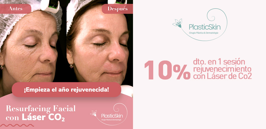 Obtén 10% dto en paquetes de 6 sesiones en Mesoterapia Capilar