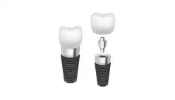 Nuestro compromiso es cuidar tu salud dental. Conoce más en dentinnoinnovaciondental.com